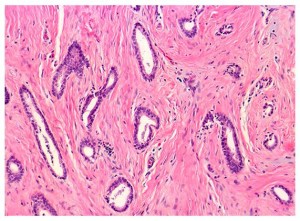 Biospecimens, Human Tissue and Cell Lines