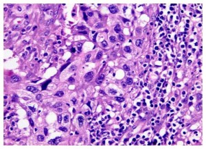 Paraffin Embedded Tissues