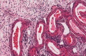 Formalin Fixed Paraffin Embedded DNA Phoenix