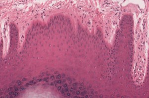 Tucson Paraffin Embedded Tissues