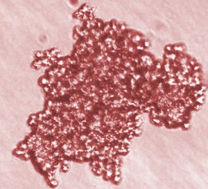 Tucson Human Tissues for Research